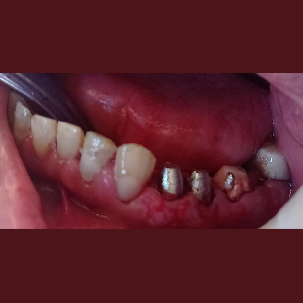 cover Προσθετική