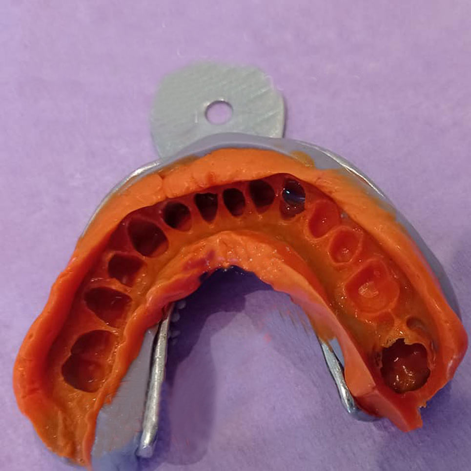 cover Προσθετική