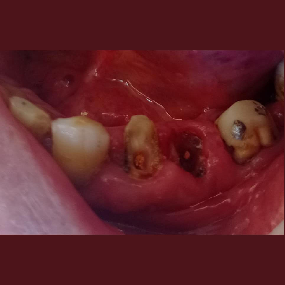 cover Προσθετική