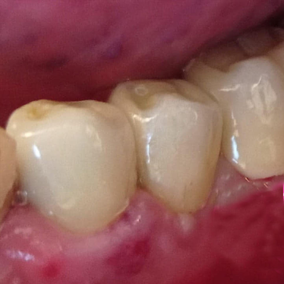 cover Προσθετική